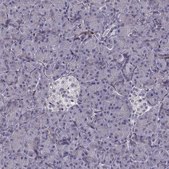 Anti-PGM5 Prestige Antibodies&#174; Powered by Atlas Antibodies, affinity isolated antibody