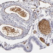 Anti-LRG1 antibody produced in rabbit Ab1, Prestige Antibodies&#174; Powered by Atlas Antibodies, affinity isolated antibody, buffered aqueous glycerol solution