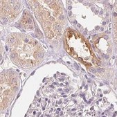 Anti-TREH antibody produced in rabbit Prestige Antibodies&#174; Powered by Atlas Antibodies, affinity isolated antibody, buffered aqueous glycerol solution