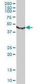 Monoclonal Anti-TUBB antibody produced in mouse clone 3B3, purified immunoglobulin, buffered aqueous solution