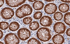 Anti-NQO1 Antibody, clone 1D12 ZooMAb&#174; Rabbit Monoclonal recombinant, expressed in HEK 293 cells
