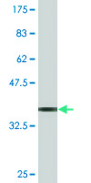 Monoclonal Anti-FZD4 antibody produced in mouse clone 3G7, purified immunoglobulin, buffered aqueous solution