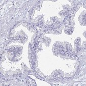 Anti-PEG10 antibody produced in rabbit Prestige Antibodies&#174; Powered by Atlas Antibodies, affinity isolated antibody, buffered aqueous glycerol solution