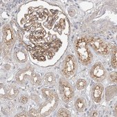 Anti-MAT2B antibody produced in rabbit Prestige Antibodies&#174; Powered by Atlas Antibodies, affinity isolated antibody, buffered aqueous glycerol solution