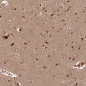Anti-POLR3A antibody produced in rabbit Prestige Antibodies&#174; Powered by Atlas Antibodies, affinity isolated antibody, buffered aqueous glycerol solution