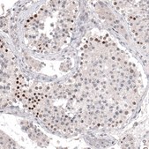 Monoclonal Anti-PRAME antibody produced in mouse Prestige Antibodies&#174; Powered by Atlas Antibodies, clone CL5148, purified immunoglobulin, buffered aqueous glycerol solution