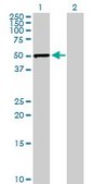 Anti-SERPINE1 antibody produced in rabbit purified immunoglobulin, buffered aqueous solution