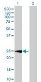 Anti-CALB1 antibody produced in rabbit purified immunoglobulin, buffered aqueous solution