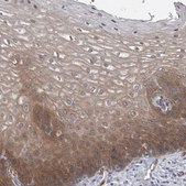 Anti-FAM83H antibody produced in rabbit Prestige Antibodies&#174; Powered by Atlas Antibodies, affinity isolated antibody, buffered aqueous glycerol solution, Ab2