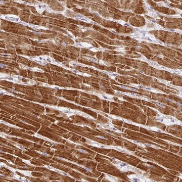 Anti-DAPK1 antibody produced in rabbit Prestige Antibodies&#174; Powered by Atlas Antibodies, affinity isolated antibody, buffered aqueous glycerol solution