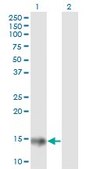 Monoclonal Anti-ACP1 antibody produced in mouse clone 2A3, purified immunoglobulin, buffered aqueous solution