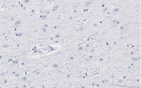 Anti-Neurogranin Antibody, clone 1D4 , ZooMAb&#174; Rabbit Monoclonal recombinant, expressed in HEK 293 cells