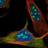 Anti-EXOSC10 antibody produced in rabbit Prestige Antibodies&#174; Powered by Atlas Antibodies, affinity isolated antibody, buffered aqueous glycerol solution, ab2