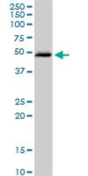 Anti-HSD3B2 antibody produced in rabbit purified immunoglobulin, buffered aqueous solution