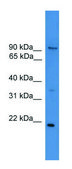 Anti-FOXM1 (N-terminal) antibody produced in rabbit affinity isolated antibody