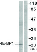 Anti-4E-BP1 antibody produced in rabbit affinity isolated antibody