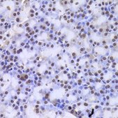 Anti-CSNK1E antibody produced in rabbit
