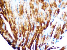 Anti-Cardiac troponin T (TNNT2) Antibody, clone 10H9D8, Rabbit Monoclonal
