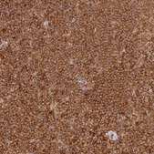 Anti-DOCK2 antibody produced in rabbit Prestige Antibodies&#174; Powered by Atlas Antibodies, affinity isolated antibody, buffered aqueous glycerol solution