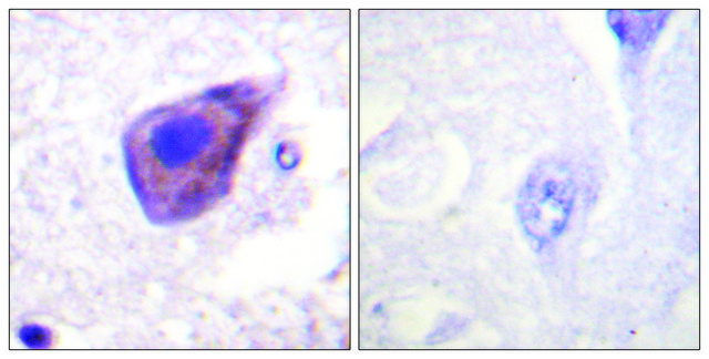 Anti-GZ-&#945; antibody produced in rabbit affinity isolated antibody