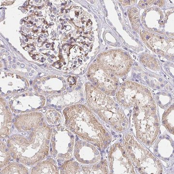 Anti-PALM2-AKAP2 antibody produced in rabbit Prestige Antibodies&#174; Powered by Atlas Antibodies, affinity isolated antibody, buffered aqueous glycerol solution