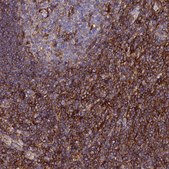 Anti-TRPV2 antibody produced in rabbit Prestige Antibodies&#174; Powered by Atlas Antibodies, affinity isolated antibody, buffered aqueous glycerol solution