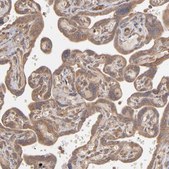 Anti-MMP2 antibody produced in rabbit Prestige Antibodies&#174; Powered by Atlas Antibodies, affinity isolated antibody, buffered aqueous glycerol solution