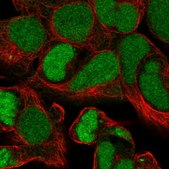 Anti-ZSCAN16 antibody produced in rabbit Prestige Antibodies&#174; Powered by Atlas Antibodies, affinity isolated antibody, buffered aqueous glycerol solution