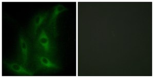 Anti-Collagen IV &#945;6 antibody produced in rabbit affinity isolated antibody