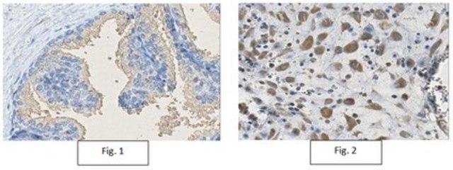 Anti-RIPK2 Antibody, clone 1H10.1 clone 1H10.1, from mouse