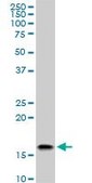 Monoclonal Anti-ACP1 antibody produced in mouse clone 2A3, purified immunoglobulin, buffered aqueous solution