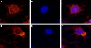 Anti-TRPV4 antibody produced in rabbit affinity isolated antibody, lyophilized powder