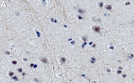 Anti-Drosha Antibody, clone 1B19 ZooMAb&#174; Rabbit Monoclonal recombinant, expressed in HEK 293 cells