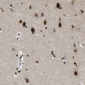 Anti-FOXK1 antibody produced in rabbit Prestige Antibodies&#174; Powered by Atlas Antibodies, affinity isolated antibody, buffered aqueous glycerol solution