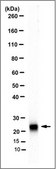 Anti-Rab7A, clone 5G8.1 Antibody clone 5G8.1, 0.5&#160;mg/mL, from mouse
