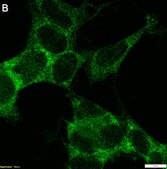 Anti-MEX3A Antibody, clone 1J23 ZooMAb&#174; Rabbit Monoclonal recombinant, expressed in HEK 293 cells