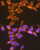 Anti-PGE receptor EP2 (PTGER2) antibody produced in rabbit