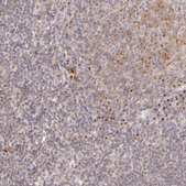 Anti-LGMN antibody produced in rabbit Prestige Antibodies&#174; Powered by Atlas Antibodies, affinity isolated antibody, buffered aqueous glycerol solution