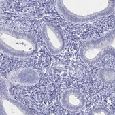 Anti-SYCP3 antibody produced in rabbit Prestige Antibodies&#174; Powered by Atlas Antibodies, affinity isolated antibody, buffered aqueous glycerol solution
