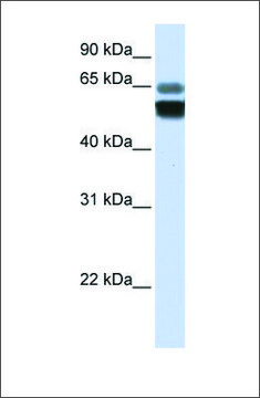 Anti-SMPD1 antibody produced in rabbit affinity isolated antibody