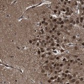 Anti-VCP antibody produced in rabbit Prestige Antibodies&#174; Powered by Atlas Antibodies, affinity isolated antibody, buffered aqueous glycerol solution