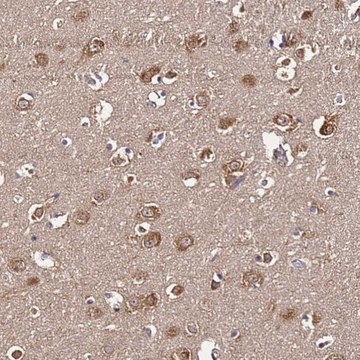 Anti-NARS antibody produced in rabbit Prestige Antibodies&#174; Powered by Atlas Antibodies, affinity isolated antibody, buffered aqueous glycerol solution