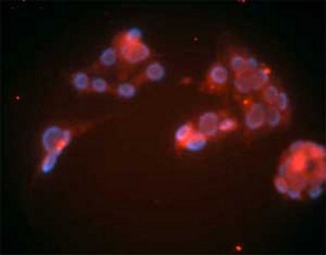 Anti-LDL Receptor Mouse mAb (15C8) liquid, clone 15C8, Calbiochem&#174;