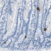 Anti-SST antibody produced in rabbit affinity isolated antibody, buffered aqueous glycerol solution