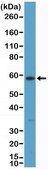 Anti-CK10 (Cytokeratin-10) Rabbit Monoclonal Antibody clone RM386, purified immunoglobulin