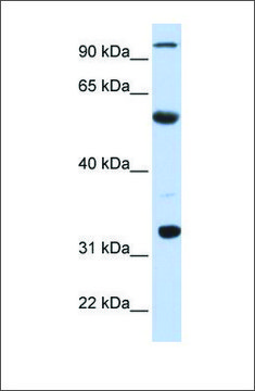 Anti-APOBEC1 antibody produced in rabbit affinity isolated antibody