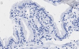 Anti-Angiopoietin-1 Antibody, clone 2F9 ZooMAb&#174; Rabbit Monoclonal recombinant, expressed in HEK 293 cells
