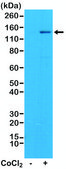 Anti-HIF-1 alpha antibody, Rabbit monoclonal recombinant, expressed in HEK 293 cells, clone RM242, purified immunoglobulin