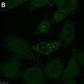 Anti-Tie-2 Antibody, clone 1C5 ZooMAb&#174; Rabbit Monoclonal recombinant, expressed in HEK 293 cells