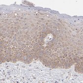 Anti-RPLP0 antibody produced in rabbit Prestige Antibodies&#174; Powered by Atlas Antibodies, affinity isolated antibody, buffered aqueous glycerol solution